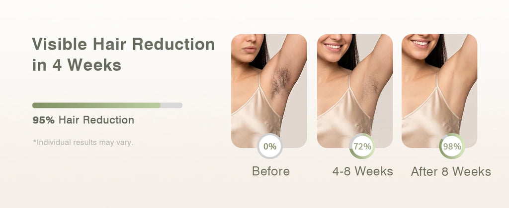 IPL Hair Removal with Ice Cooling Function for Women,Long-Lasting Results,999,999 Flashes Painless Hair Removal for Armpits Legs