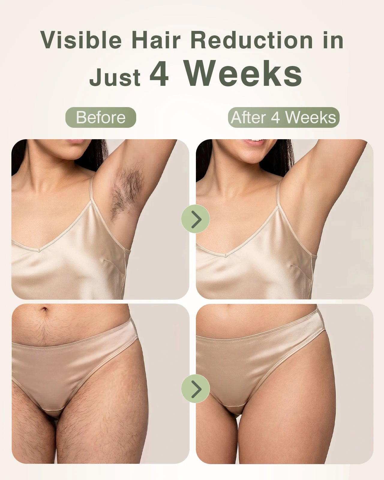 IPL Hair Removal with Ice Cooling Function for Women,Long-Lasting Results,999,999 Flashes Painless Hair Removal for Armpits Legs